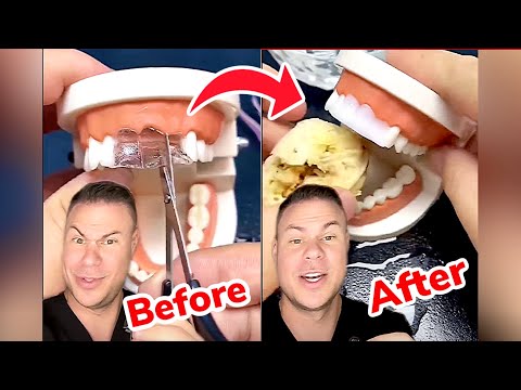 Instant Fake Teeth In SECONDS?! Orthodontist Reacts